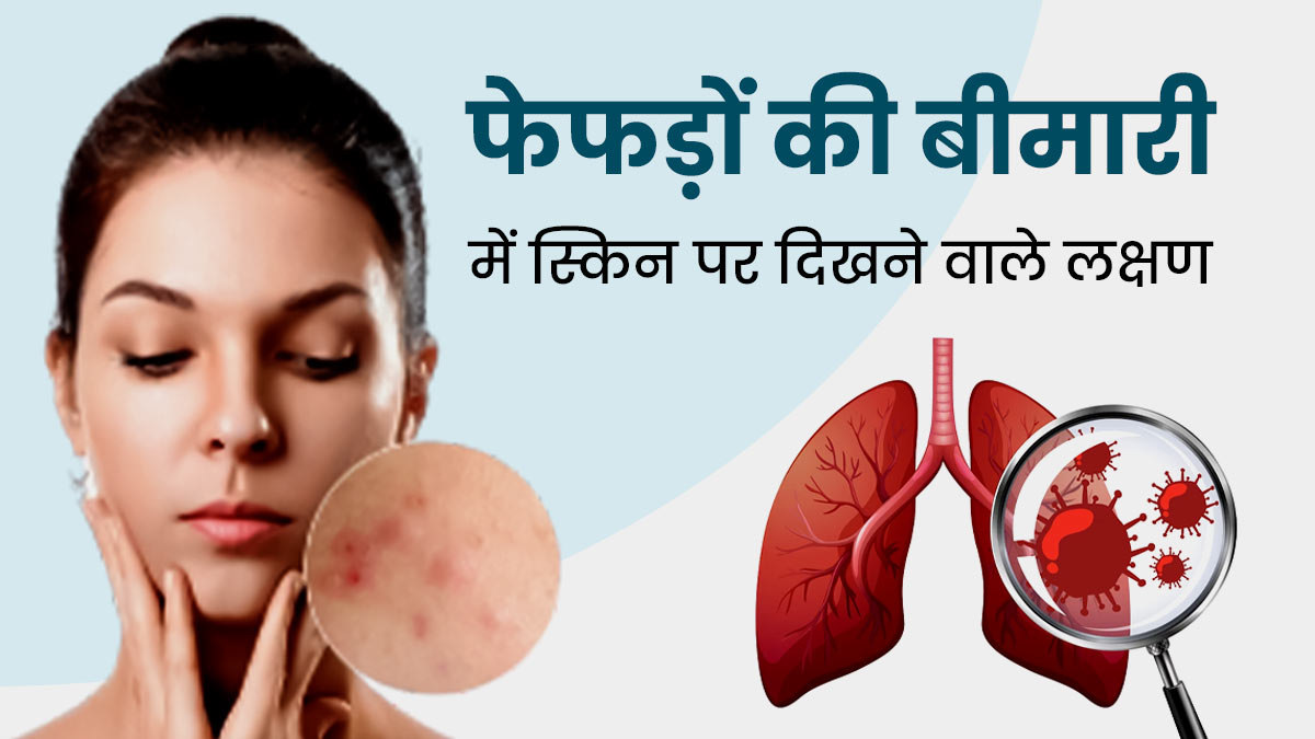 फेफड़ों की बीमारी होने पर स्किन पर दिखते हैं ये लक्षण, न करें नजरअंदाज