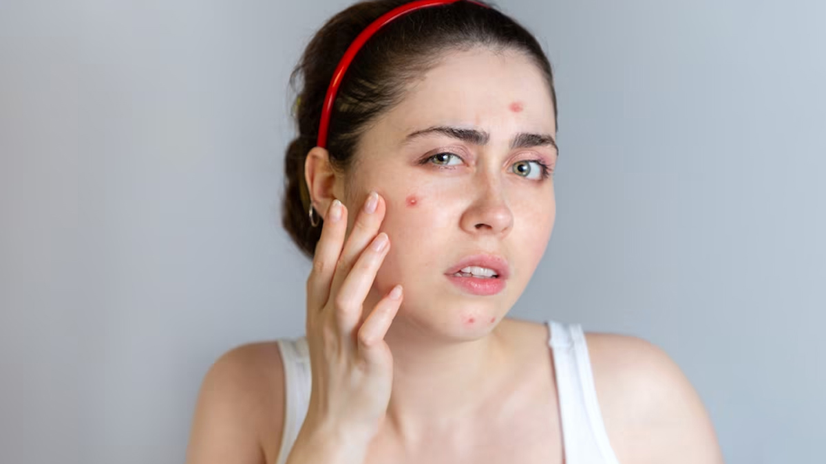 allergic-reaction
