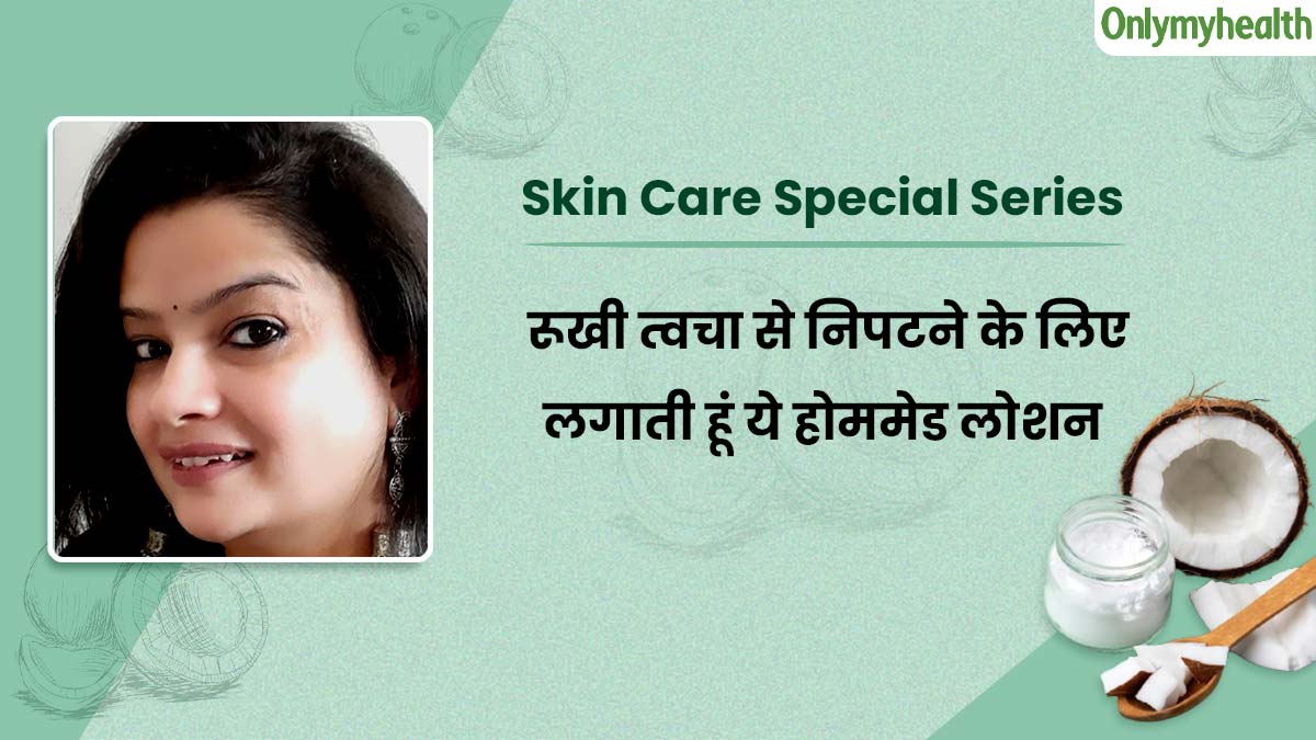 इस मौसम में रूखी त्‍वचा से न‍िपटने के ल‍िए लगाती हूं ये होममेड लोशन, स्‍क‍िन में एड हो गया है ग्‍लो 