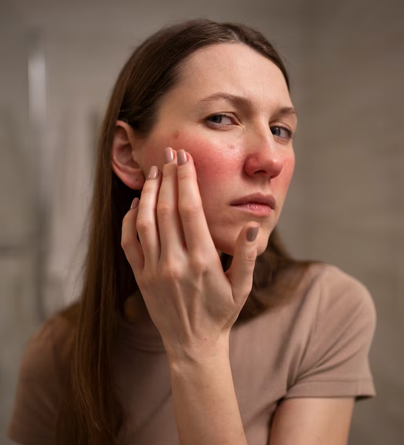 irritated-skin