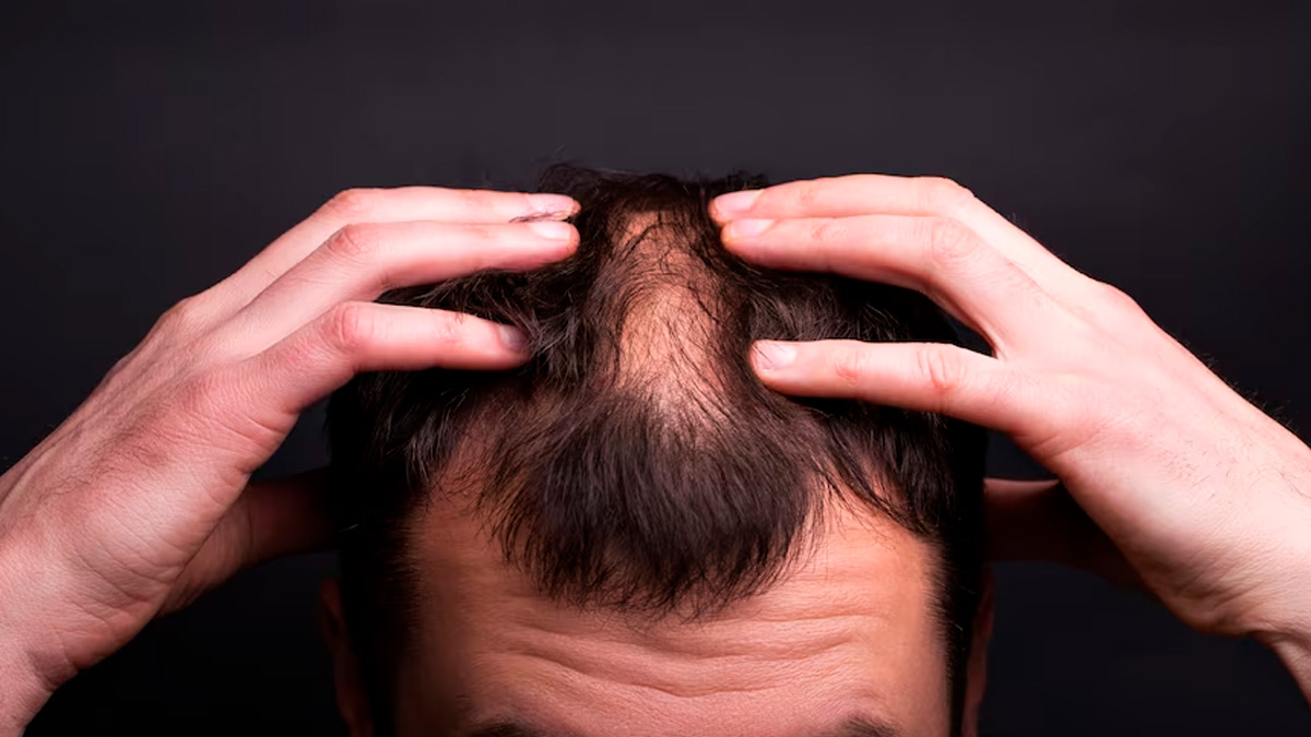 fungal infection on scalp