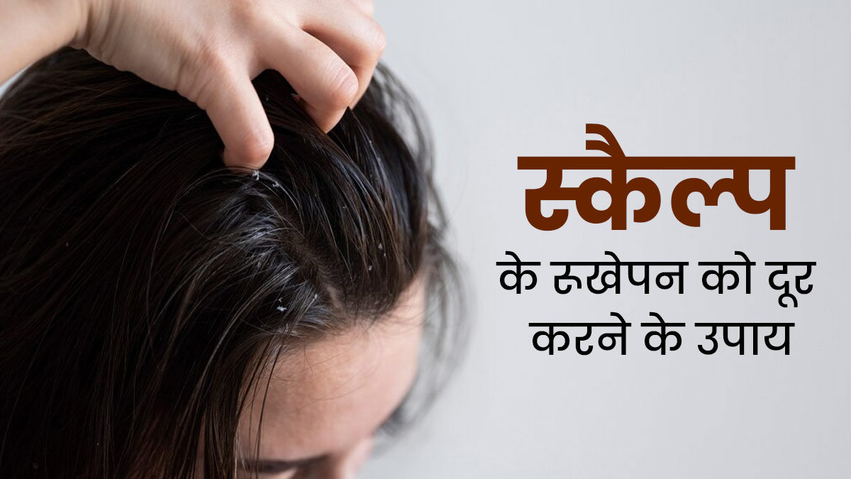 बदलते मौसम में स्कैल्प के रूखेपन को दूर करने के लिए अपनाएं ये 5 घरेलू उपाय, मिलेगी राहत 
