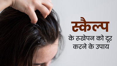 बदलते मौसम में स्कैल्प के रूखेपन को दूर करने के लिए अपनाएं ये 5 घरेलू उपाय, मिलेगी राहत 