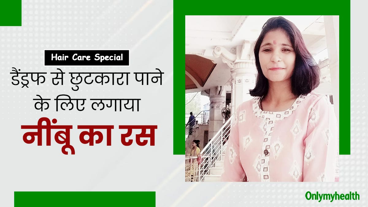 डैंड्रफ की समस्या से छुटकारा पाने के लिए मानवी ने लगाया नींबू का रस, जानें कैसे किया इस्तेमाल