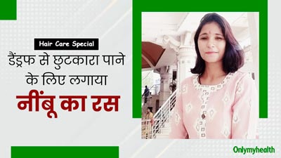 डैंड्रफ की समस्या से छुटकारा पाने के लिए मानवी ने लगाया नींबू का रस, जानें कैसे किया इस्तेमाल