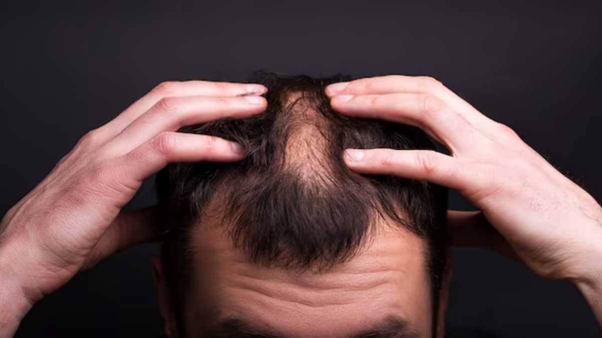 Can eating or applying eggs prevent hair fall