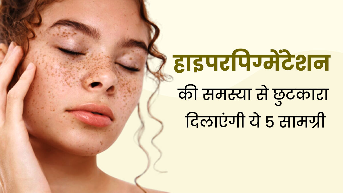 हाइपरपिग्मेंटेशन की समस्या से परेशान हैं, तो इस्तेमाल करें घर में मौजूद ये 5 चीजें