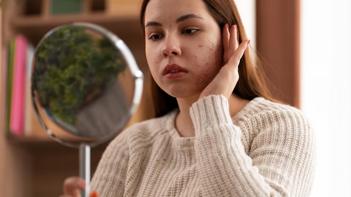 Pre Wedding Skincare Tips by Experts