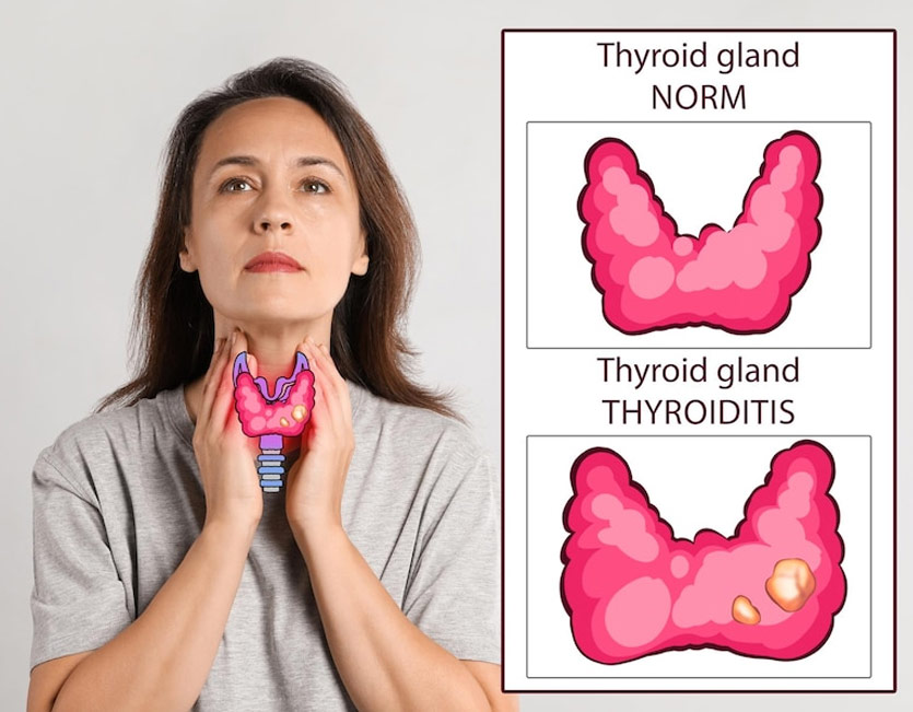 Thyroid In Pregnancy Symptoms In Hindi