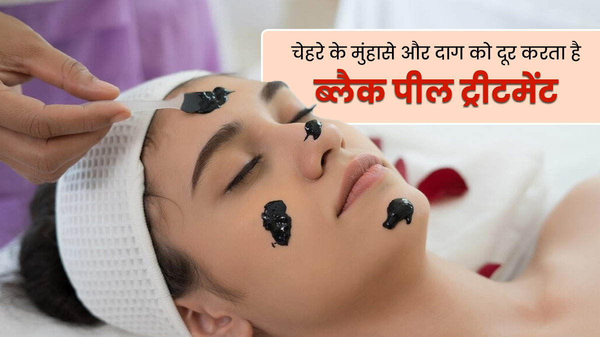 Black Peel Treatment: मुंहासों और दाग-धब्बों को दूर करेगा ब्लैक पील ट्रीटमेंट, जानें इसके बारे में