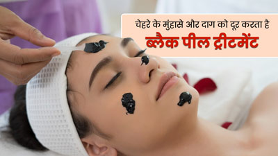 Black Peel Treatment: मुंहासों और दाग-धब्बों को दूर करेगा ब्लैक पील ट्रीटमेंट, जानें इसके बारे में