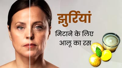 झुर्रियां मिटाने के लिए आलू का रस का इस्तेमाल कैसे करें? जानें 4 तरीके, जिनसे एजिंग से मिलेगा छुटकारा