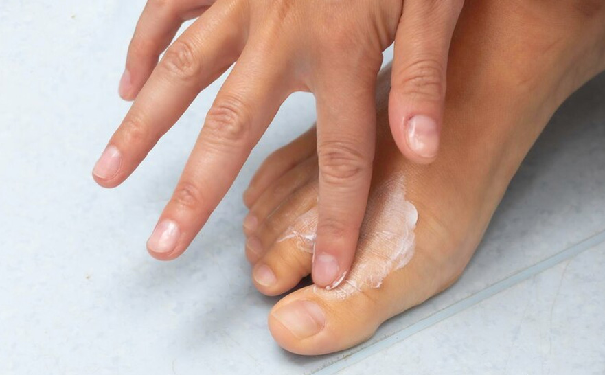 athletes foot causes in hindi 