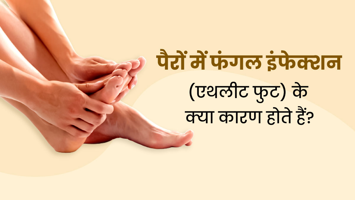 एथलीट फुट (पैरों में फंगल इंफेक्शन) की समस्या क्यों होती है? डॉक्टर से जानें इसके कारण और इलाज 