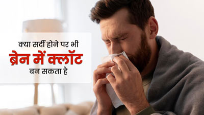 क्या सर्दी होने पर भी ब्रेन में क्लॉट बन सकता है? जानें क्या हो सकते हैं कारण 