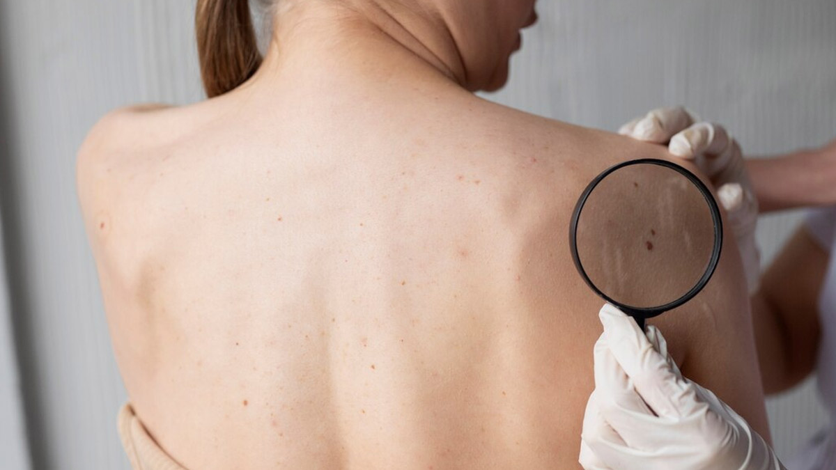 14-Year-Old Young Scientist Invents A Soap That Could Possibly Treat Skin Cancer