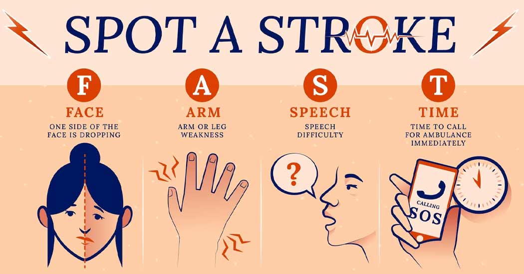 About 80% Of Strokes Are Preventable: 5 Ways To Cut Down Your Risk ...