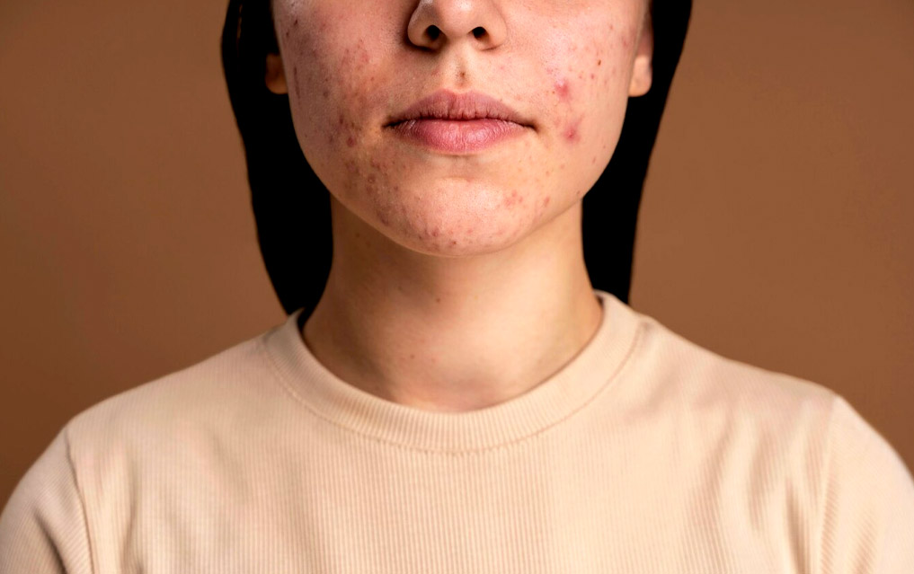 Signs on face that says about your health