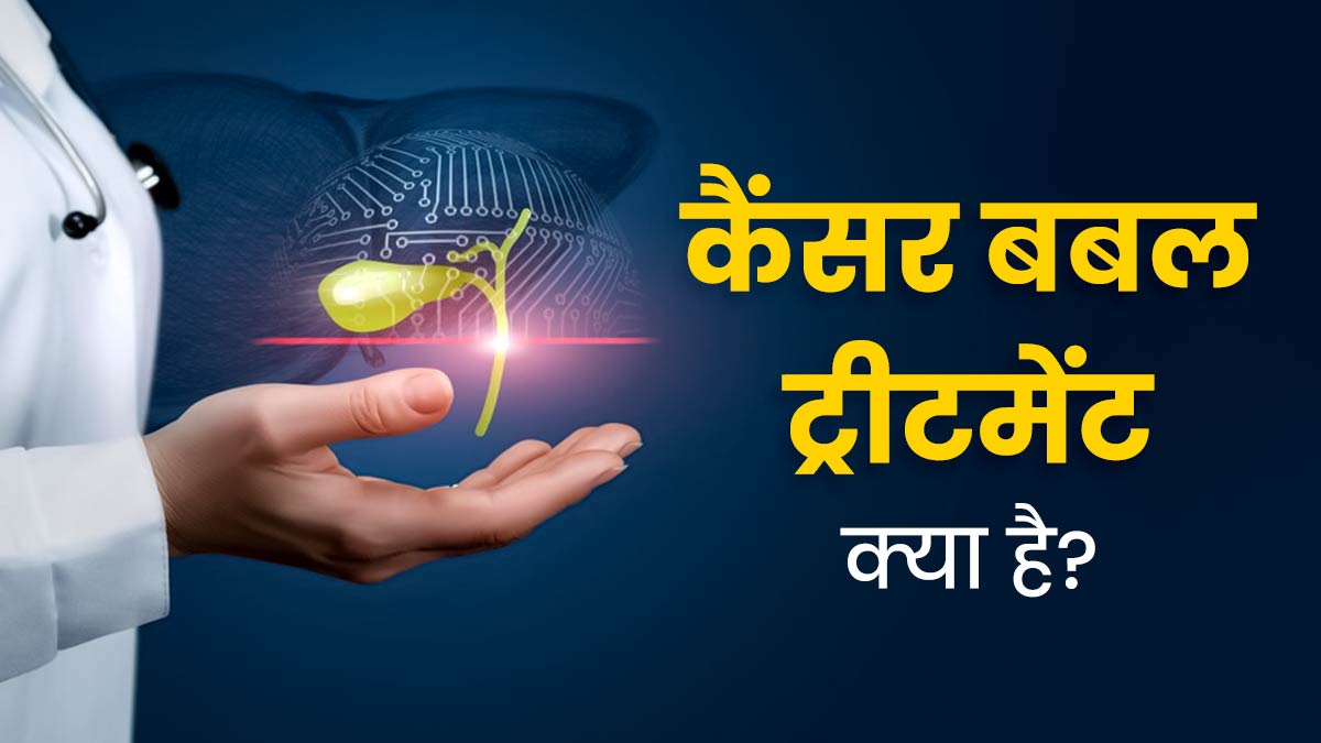 लिवर कैंसर के इलाज के लिए FDA ने दी बबल ट्रीटमेंट को मंजूरी, जानें इसके बारे में