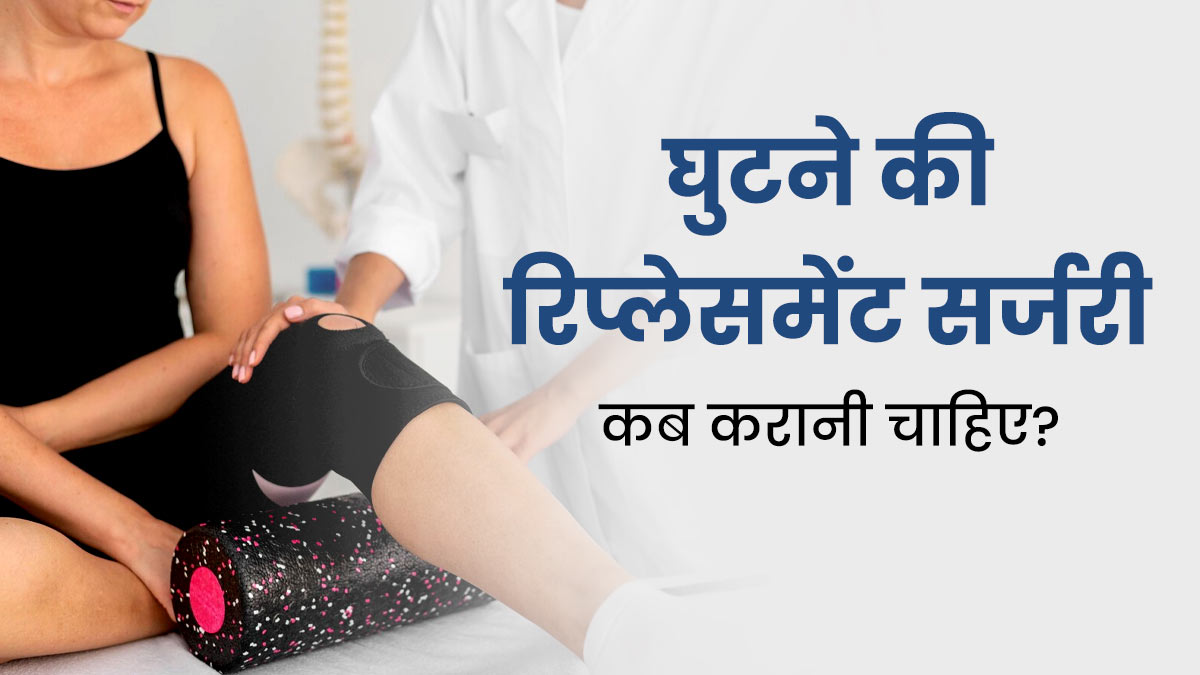 Knee Replacement Surgery: घुटने की रिप्लेसमेंट सर्जरी कब करानी चाहिए? डॉक्टर से जानें 