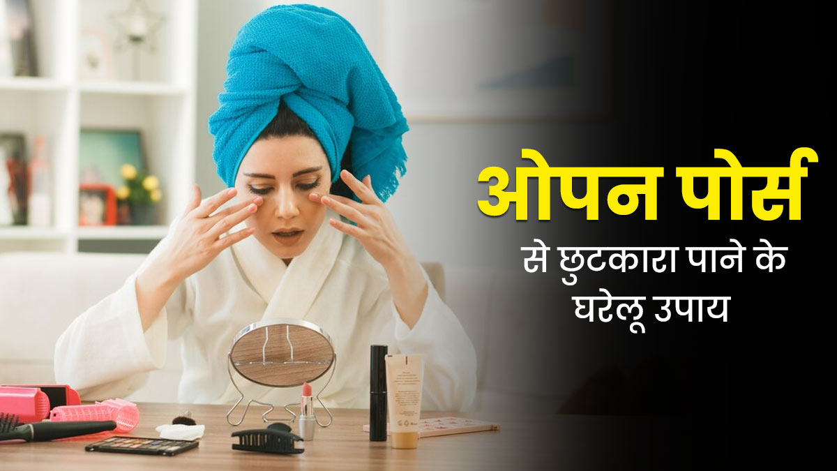 Open Pores: ओपन पोर्स से छुटकारा पाने के लिए अपनाएं ये 5 घरेलू उपाय, दिखेगा फर्क