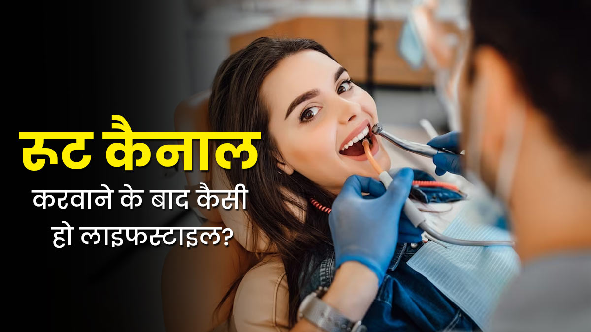 रूट कैनाल करवाने के बाद कैसी हो आपकी लाइफस्टाइल? जानें एक्सपर्ट से