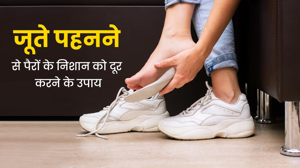 जूते पहनने से पैरों में पड़ गए हैं निशान? इन्हें हटाने के लिए अपनाएं ये 5 घरेलू उपाय 