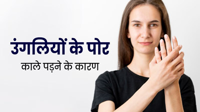 हाथ और पैर की उंगलियों के पोर काले क्यों पड़ जाते हैं? डर्मेटोलॉजिस्ट से जानें 7 कारण