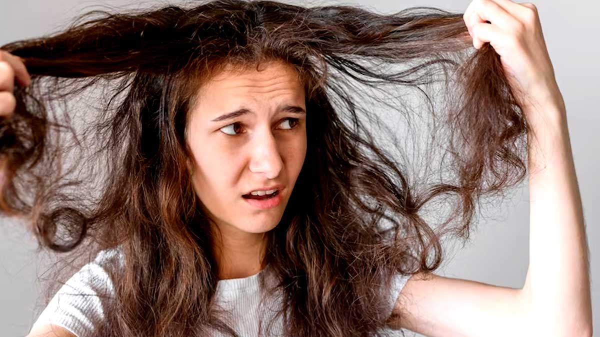 ऑयली स्कैल्प और ड्राई बालों की समस्या से परेशान हैं, तो राहत के ल‍िए अपनाएं ये 5 उपाय 