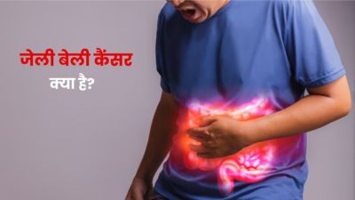 जेली बेली कैंसर क्या है? जानें इसके कारण, लक्षण और इलाज
