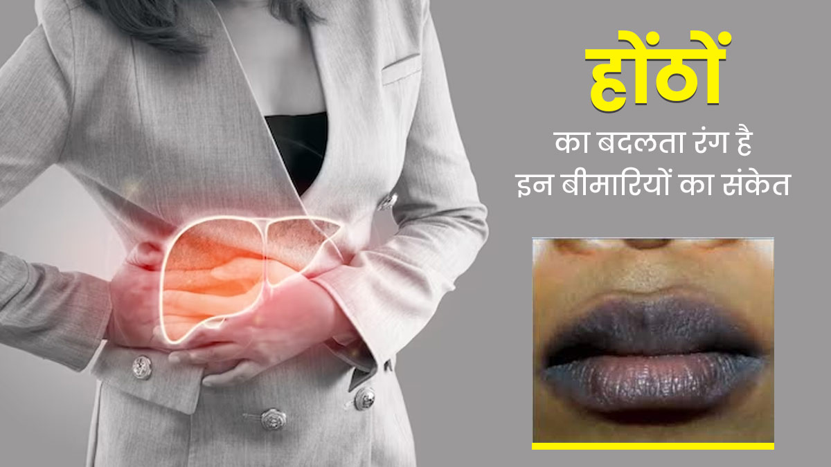 होंठों का बदलता रंग हो सकता है इन 5 बीमारियों का संकेत, न करें नजरअंदाज