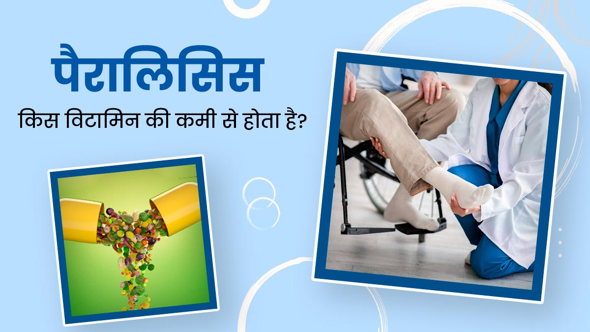 शरीर में इस विटामिन की कमी से हो सकता है पैरालिसिस, जानें इन दोनों में संबंध