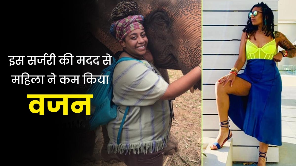 वजन कम करने के लिए इस फोटोग्राफर महिला ने करवाई VSG Surgery, जानें क्या है यह और कैसे की जाती है?