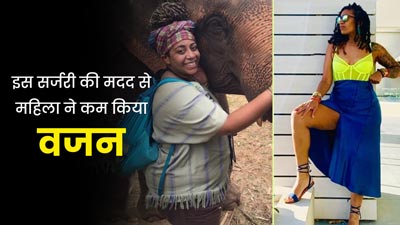 वजन कम करने के लिए इस फोटोग्राफर महिला ने करवाई VSG Surgery, जानें क्या है यह और कैसे की जाती है?