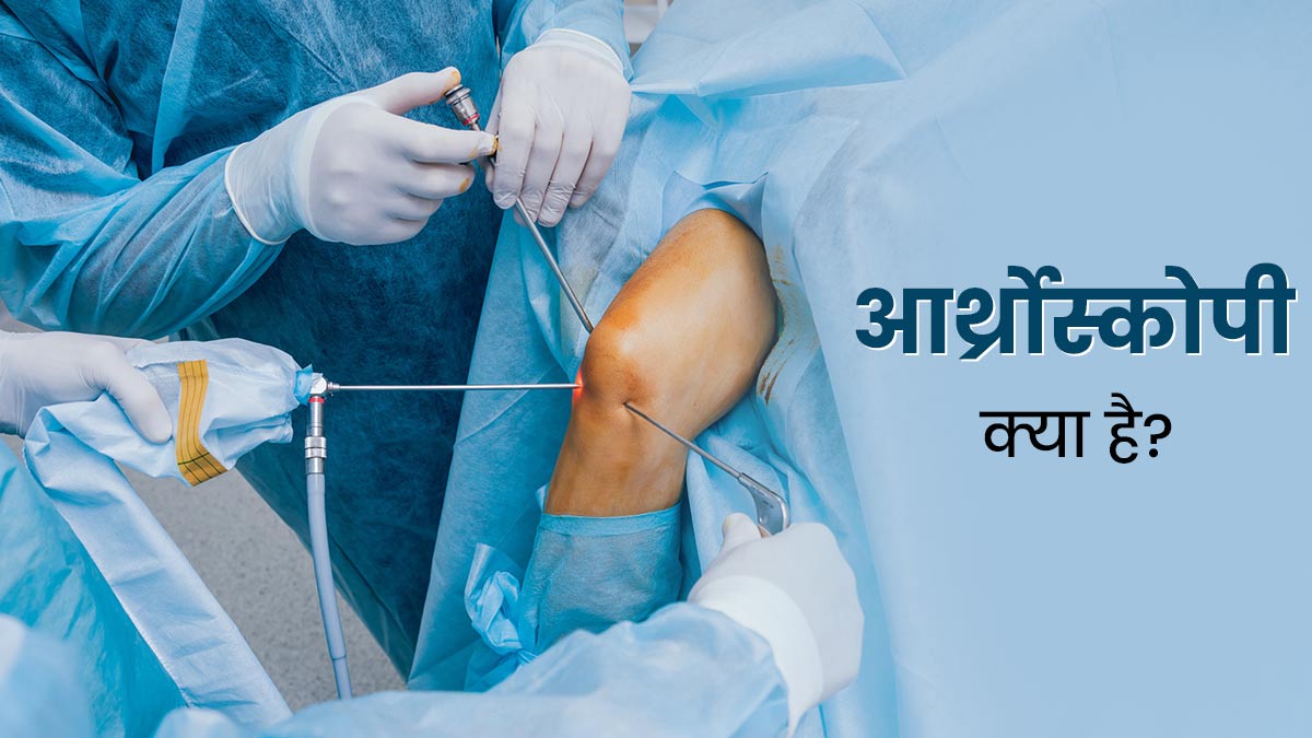 Knee Arthroscopy: आर्थ्रोस्कोपी क्या है और जोड़ों की समस्या में इसकी जरूरत कब पड़ती है? डॉक्‍टर से जानें 