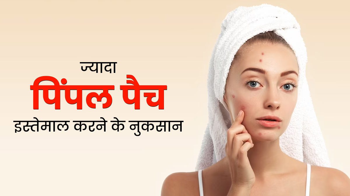 पिंपल पैच इस्तेमाल करने से चेहरे को हो सकते हैं कई नुकसान, जानें इस बारे में 