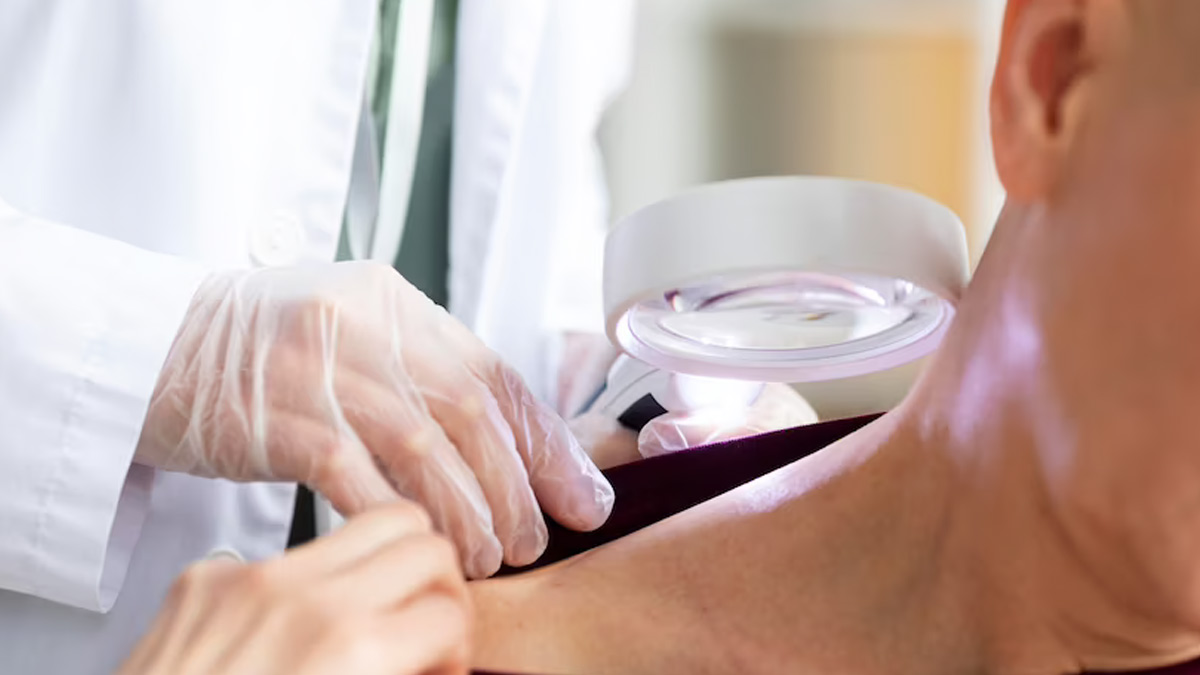 Rashes: Here’s How To Identify When It Can Turn Serious 