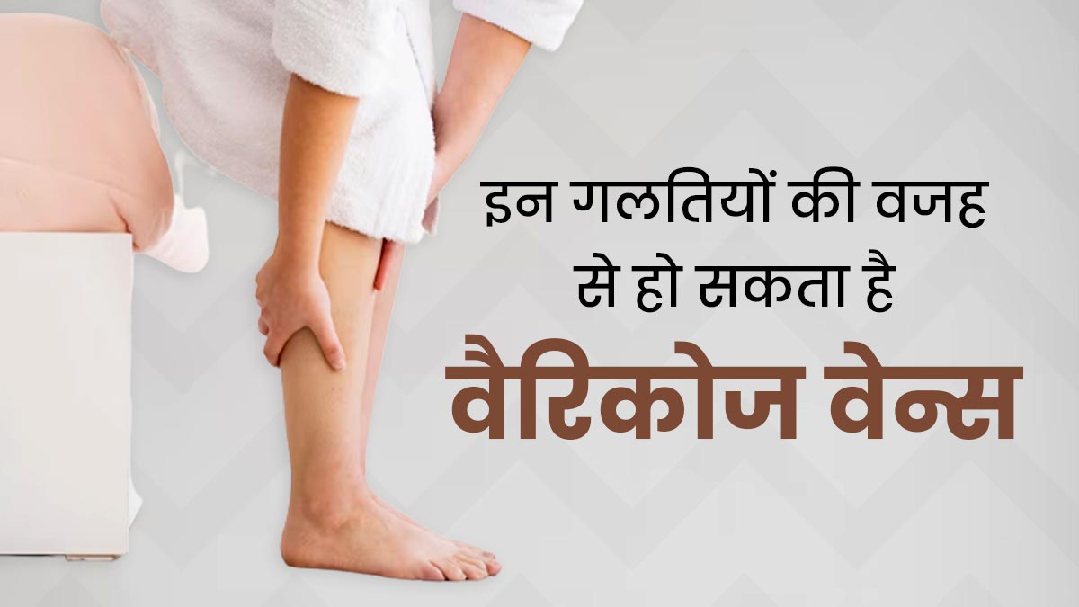 आपकी ये 4 गलतियां बना सकती हैं वैरिकोज वेन्स (पैरों में नीली उभरी नसों) की समस्या का कारण, न करें लापरवाही