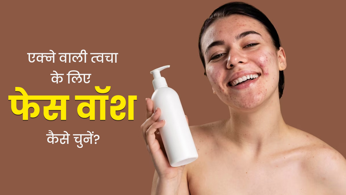 मुंहासों वाली स्किन के लिए सही फेस वॉश (Anti Acne Face Wash) कैसे चुनें? एक्‍सपर्ट से जानें सही तरीका  