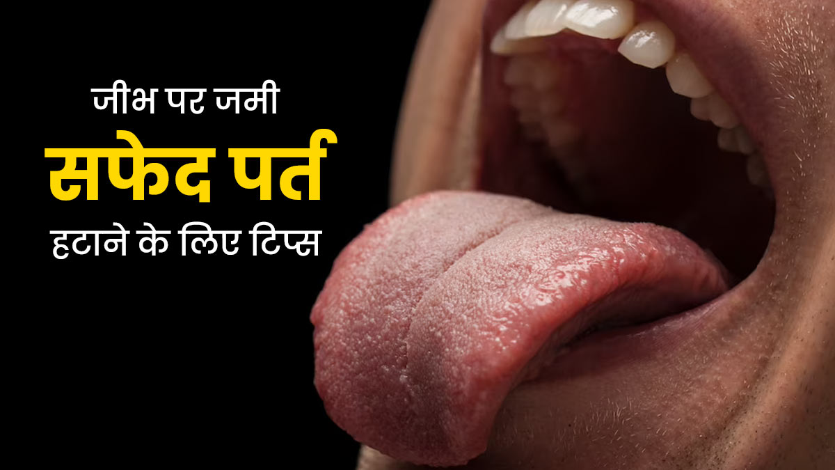 जीभ पर जमी सफेद पर्त हटाने के लिए अपनाएं ये 5 टिप्स, दिखेगा जल्द असर