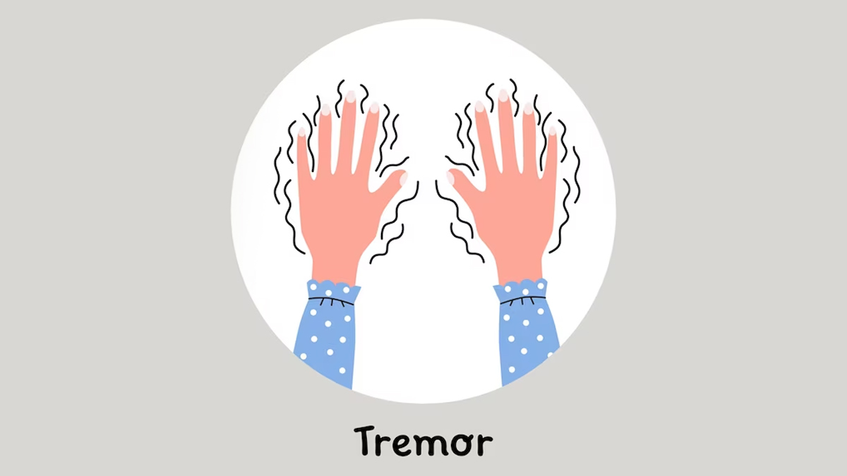 Tremor-Syndromes