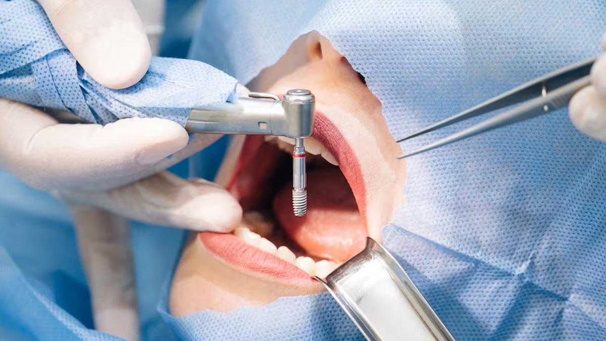 root canal treatment in hindi