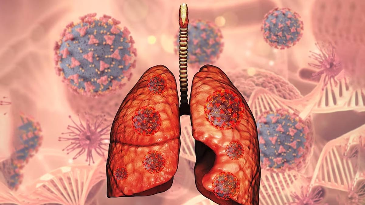 Recognise THESE Lesser Known Signs Of Lung Cancer, May Help In Early ...