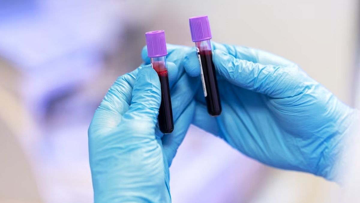 Blood Test To Check Vitamins And Minerals In Hindi