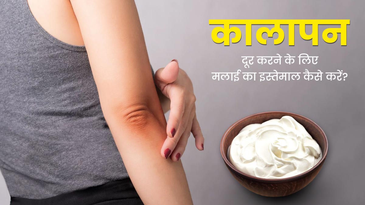 कोहनी और घुटनों का कालापन दूर करने के लिए इन 4 तरीकों से करें मलाई का इस्तेमाल