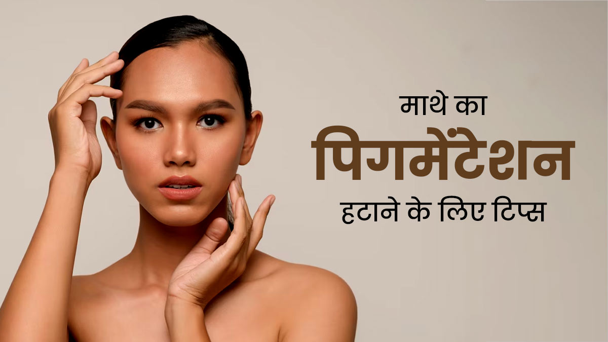 Forehead Pigmentation: माथे के धब्बे और कालापन हटाने के लिए अपनाएं ये 5 टिप्स, जल्द दिखेगा असर