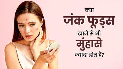 क्या जंक फूड्स खाने से भी मुंहासे ज्यादा होते हैं? जानें डॉक्टर से 