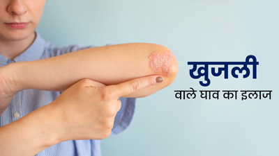 घाव के बाद स्किन पर होने वाली खुजली को दूर करने के लिए अपनाएं डॉक्टर के बताए ये टिप्स