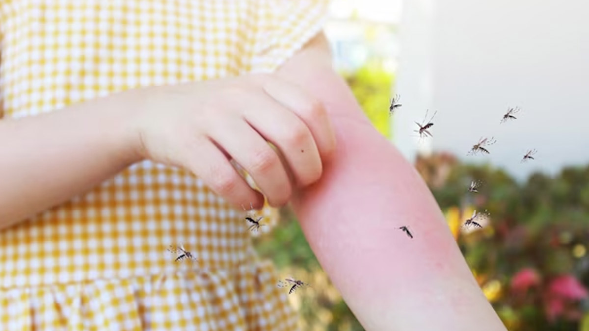 Malaria Prevention Tips For Children