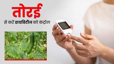 डायबिटीज में तोरई खाना हो सकता है फायदेमंद, एक्सपर्ट से जानें ब्लड शुगर कंट्रोल के अलावा मिलने वाले फायदे